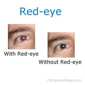 Des yeux avec des yeux rouges